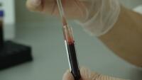 krev1 blood-20745 1280
